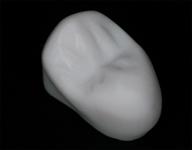 Initial crown milled by the CEREC machine