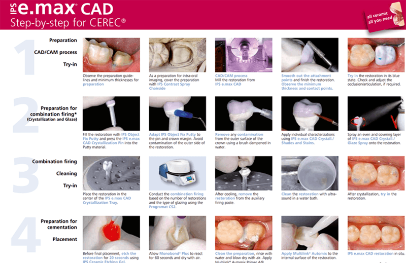 Full Cerec Process